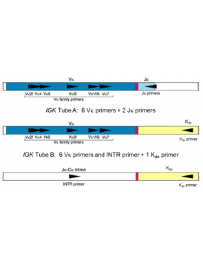 IGK Gene Clonality Assay - Gel