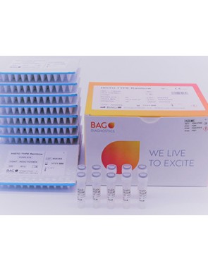 Typage HLA par PCR en temps...