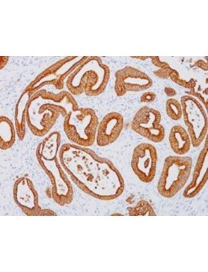 Cytokeratine 18 clone DC10