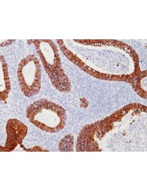 Cytokeratine 20 clone Ks20,8