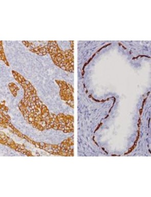 Cytokeratine HMW clone 34BE12