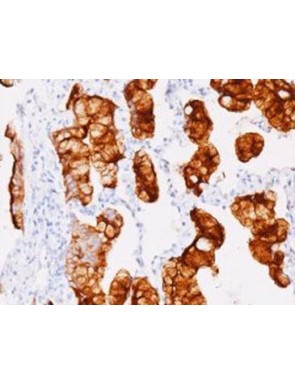 Mesothelin clone MSLN-15C11