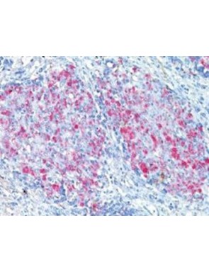 Mycobacterium tuberculosis