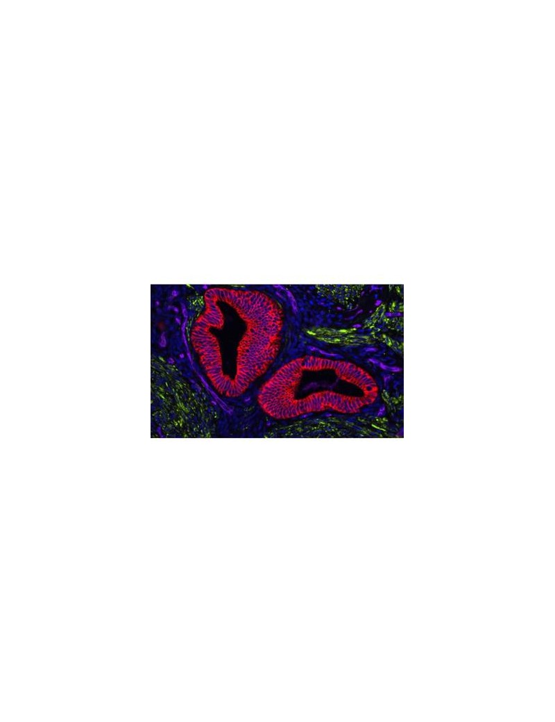 VECTASHIELD Vibrance Antifade Mounting Medium (hardening) + DAPI