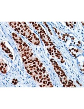 Progesterone repteur clone SP2