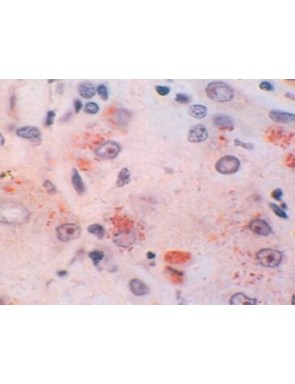 Wilson Disease Stain for...