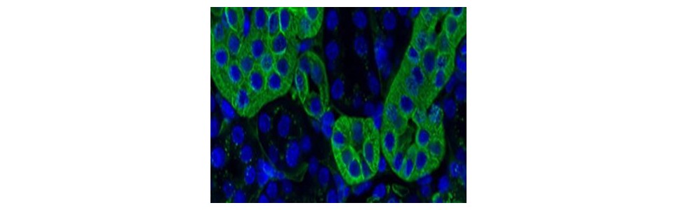 Lectines Glycobiologie