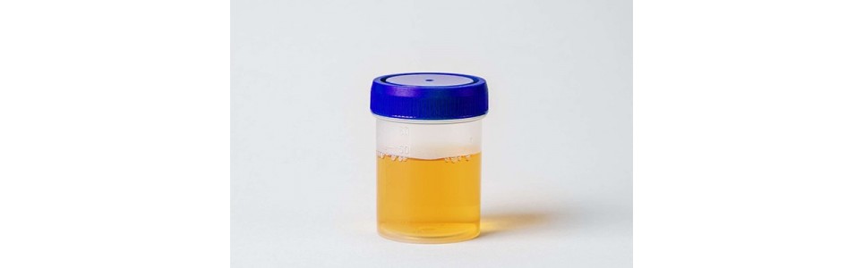 Toxicologie Urine