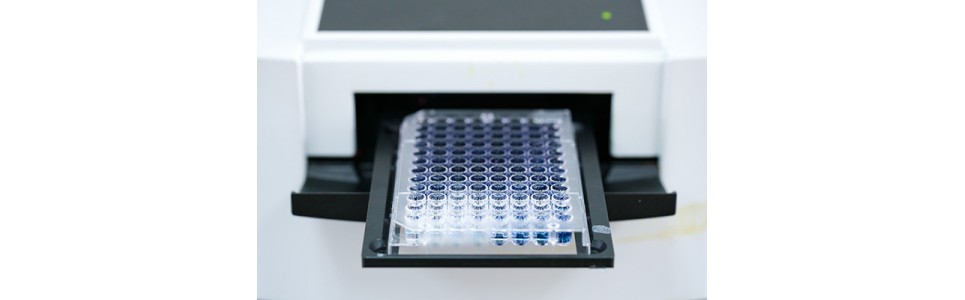 Recherche d'anticorps anti HLA par Elisa
